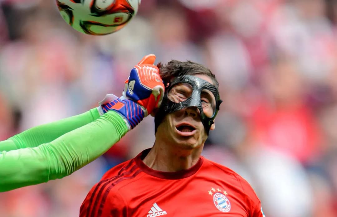 Dlaczego Lewandowski grał w masce? Szokująca prawda o kontuzji